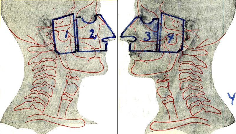 Epipharynxfält